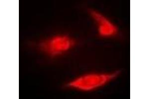 Immunofluorescent analysis of PSMB2 staining in U2OS cells. (PSMB2 anticorps)