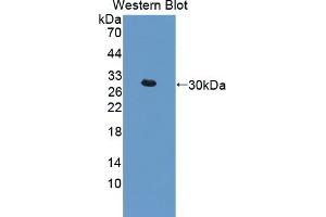 Detection of Recombinant IkBd, Mouse using Polyclonal Antibody to Inhibitory Subunit Of NF Kappa B Delta (IkBd) (IkBd anticorps  (AA 58-304))