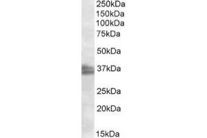 AP20113PU-N FRG1 antibody staining of Jurkat nuclear lysate at 2 µg/ml (RIPA buffer, 35 µg total protein per lane). (FRG1 anticorps  (Internal Region))