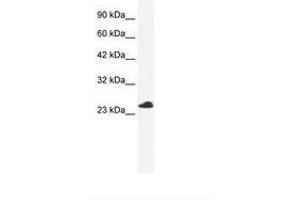 Image no. 1 for anti-Chromosome 14 Open Reading Frame 166 (C14orf166) (AA 85-134) antibody (ABIN6735987)