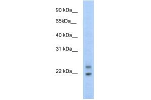 WB Suggested Anti-C330003B14RIK Antibody Titration:  5. (CPHX anticorps  (N-Term))