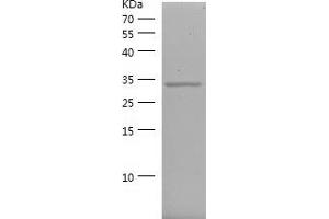 Western Blotting (WB) image for Cyclin-Dependent Kinase 4 (CDK4) (AA 207-303) protein (His-IF2DI Tag) (ABIN7122532)