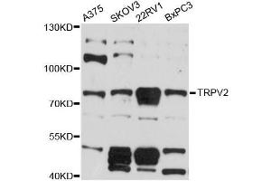 Western blot analysis of extracts of various cell lines, using TRPV2 antibody (ABIN5999110) at 1:3000 dilution. (TRPV2 anticorps)