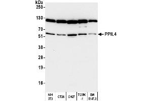 anti-Peptidylprolyl Isomerase (Cyclophilin)-Like 4 (PPIL4) (AA 375-425) antibody