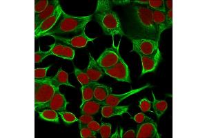 Immunofluorescent staining of MCF cells using Cytokeratin 18 Mouse Monoclonal Antibody (KRT18/834).