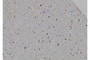 ABIN6277059 at 1/100 staining Human heart tissue by IHC-P.
