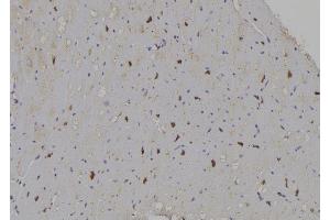 ABIN6277059 at 1/100 staining Human heart tissue by IHC-P. (E2F1 anticorps  (C-Term))