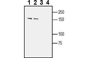 anti-Slit Homolog 1 (SLIT1) (AA 1170-1184), (Secreted) antibody