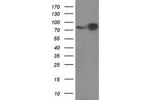 Western Blotting (WB) image for anti-Catenin (Cadherin-Associated Protein), beta 1, 88kDa (CTNNB1) antibody (ABIN1496893)