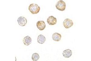 Immunocytochemistry of DISC1 in HeLa cells with AP30292PU-N DISC1 antibody at 5 μg/ml.