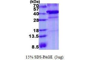 Figure annotation denotes ug of protein loaded and % gel used. (XRCC3 Protéine)