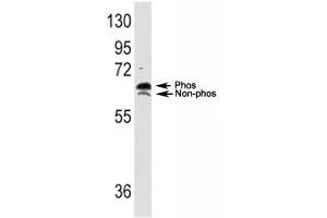 Western blot analysis of p70S6K antibody and TNF alpha activated HeLa lysate; both phospho and non-phos S6K can be detected with this Ab.