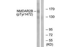 Western blot analysis of extracts from Jurkat cells treated with UV 15', using NMDAR2B (Phospho-Tyr1474) Antibody. (GRIN2B anticorps  (pTyr1474))