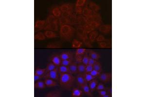 Immunofluorescence analysis of  cells using SSC/SerpinB3 Rabbit pAb (ABIN6131348, ABIN6147587, ABIN6147588 and ABIN6221070) at dilution of 1:100 (40x lens). (SERPINB3 anticorps  (AA 1-230))