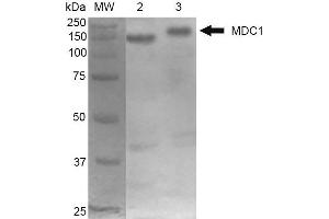 Western Blot analysis of Mouse Cortex and Cerebellum showing detection of 184 kDa MDC1 protein using Mouse Anti-MDC1 Monoclonal Antibody, Clone P2B11 . (MDC1 anticorps  (N-Term) (Biotin))
