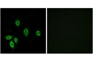 Immunofluorescence analysis of A549 cells, using TRHR Antibody. (TRHR anticorps  (AA 195-244))