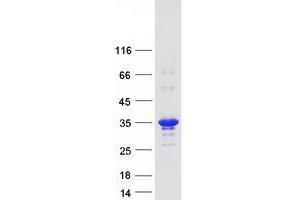 Validation with Western Blot (KCTD15 Protein (Transcript Variant 1) (Myc-DYKDDDDK Tag))