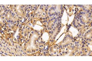 Detection of PIIINP in Human Stomach Tissue using Monoclonal Antibody to Procollagen III N-Terminal Propeptide (PIIINP)