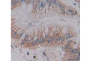 Used in DAB staining on fromalin fixed paraffin- embedded Kidney tissue (MUC3B anticorps  (AA 836-931))