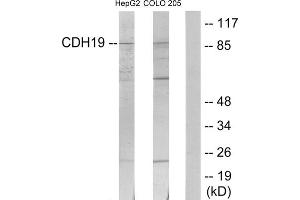 Western blot analysis of extracts from HepG2 cells and COLO205 cells, using CDH19 antibody. (CDH19 anticorps  (Internal Region))