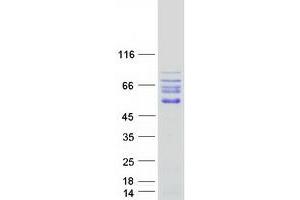 Validation with Western Blot