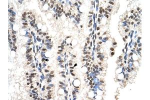 RUNDC2A antibody was used for immunohistochemistry at a concentration of 4-8 ug/ml to stain Epithelial cells of intestinal villus (arrows) in Human Intestine. (SNX29 anticorps  (N-Term))