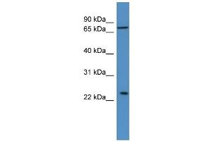 WB Suggested Anti-MOBKL2A Antibody Titration: 0.