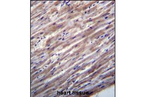 RASD1 Antibody (C-term) (ABIN657026 and ABIN2846202) immunohistochemistry analysis in formalin fixed and paraffin embedded human heart tissue followed by peroxidase conjugation of the secondary antibody and DAB staining. (RASD1 anticorps  (C-Term))