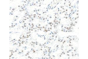Immunohistochemistry (IHC) image for anti-Cleavage and Polyadenylation Specific Factor 1, 160kDa (CPSF1) (AA 1392-1442) antibody (ABIN7453881)