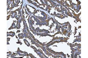 IHC analysis of TRMT61B using anti-TRMT61B antibody (ABIN7602334). (TRMT61B anticorps  (AA 7-477))