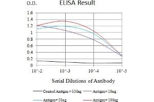 Black line: Control Antigen (100 ng),Purple line: Antigen (10 ng), Blue line: Antigen (50 ng), Red line:Antigen (100 ng) (IL17RA anticorps  (AA 33-320))