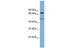 STIM1 antibody used at 1 ug/ml to detect target protein. (STIM1 anticorps  (Middle Region))