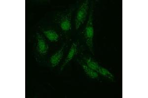 IF analysis of KI/VIRMA using anti-KI/VIRMA antibody (ABIN7599707). (Protein Virilizer Homolog (VIRMA) (AA 11-1529) anticorps)
