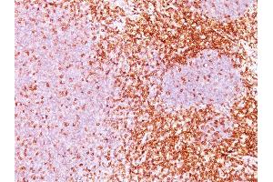 Formalin-fixed, paraffin-embedded human Tonsil (10X) stained with CD6 Monoclonal Antibody (3F7B5). (CD6 anticorps)