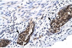 Human Stomach (E2F4 anticorps  (C-Term))