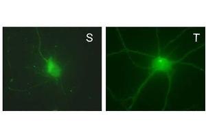 Cultured rat hippocampal neuron surface (S, left) and total (T, right) protein immunofluorescence staining (green) with N151/3 (2 mg/mL).