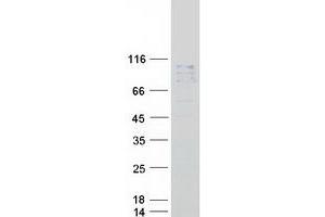 Validation with Western Blot