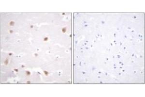 Immunohistochemistry analysis of paraffin-embedded human brain tissue, using CKII-beta (Ab-209) Antibody. (CSNK2B anticorps  (AA 166-215))
