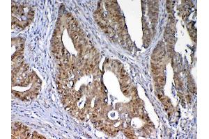 IHC analysis of Dnmt1 using anti-Dnmt1 antibody .
