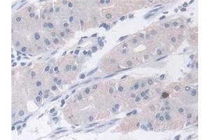 Detection of ARPC2 in Human Stomach Tissue using Polyclonal Antibody to Actin Related Protein 2/3 Complex Subunit 2 (ARPC2)