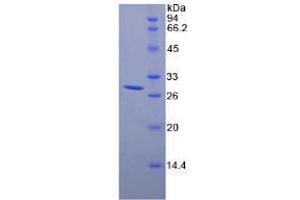SDS-PAGE analysis of Mouse RIG1 Protein.