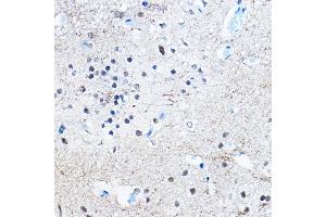 Immunohistochemistry of paraffin-embedded rat brain using Phospho-Tau-S396 Rabbit mAb (ABIN7268523) at dilution of 1:100 (40x lens). (MAPT anticorps  (pSer396))