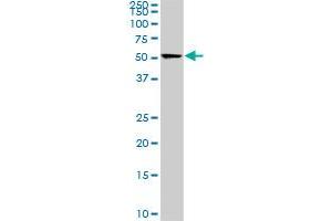 CDK8 monoclonal antibody (M02), clone 6E5. (CDK8 anticorps  (AA 375-464))