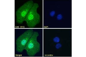 ABIN768601 Immunofluorescence analysis of paraformaldehyde fixed U2OS cells, permeabilized with 0.