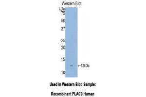 Western Blotting (WB) image for anti-Placenta-Specific 9 (PLAC9) (AA 23-97) antibody (ABIN1078445) (PLAC9 anticorps  (AA 23-97))