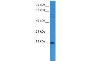 Western Blotting (WB) image for anti-Growth Arrest and DNA-Damage-Inducible, alpha (GADD45A) (C-Term) antibody (ABIN2788360) (GADD45A anticorps  (C-Term))