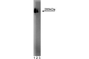 Western Blotting (WB) image for anti-Fatty Acid Synthase (FASN) (AA 9-202) antibody (ABIN968279) (Fatty Acid Synthase anticorps  (AA 9-202))