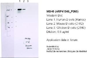 Western Blotting (WB) image for anti-MutS Homolog 6 (E. Coli) (MSH6) (N-Term) antibody (ABIN2776759) (MSH6 anticorps  (N-Term))