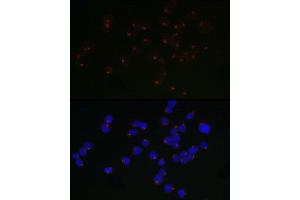Immunofluorescence analysis of Jurkat cells using  / ARP Rabbit mAb (ABIN7265490) at dilution of 1:50 (40x lens). (ARFRP1 anticorps)