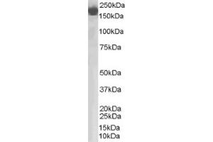 Image no. 1 for anti-Complement Factor H (CFH) (Internal Region) antibody (ABIN374588) (Complement Factor H anticorps  (Internal Region))